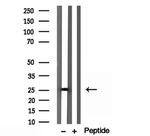 IFT25 Antibody in Western Blot (WB)