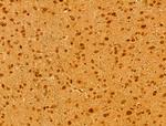 MCM10 Antibody in Immunohistochemistry (Paraffin) (IHC (P))