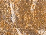 MCM10 Antibody in Immunohistochemistry (Paraffin) (IHC (P))