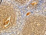 MCM10 Antibody in Immunohistochemistry (Paraffin) (IHC (P))