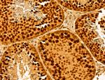 MCM10 Antibody in Immunohistochemistry (Paraffin) (IHC (P))