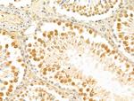 MCM10 Antibody in Immunohistochemistry (Paraffin) (IHC (P))