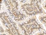 MCM10 Antibody in Immunohistochemistry (Paraffin) (IHC (P))