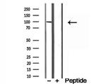 MCM10 Antibody in Western Blot (WB)