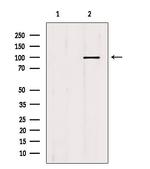 MCM10 Antibody in Western Blot (WB)