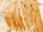 Melanophilin Antibody in Immunohistochemistry (Paraffin) (IHC (P))