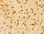 NUDT21 Antibody in Immunohistochemistry (Paraffin) (IHC (P))