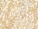 NUDT21 Antibody in Immunohistochemistry (Paraffin) (IHC (P))