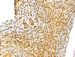 NUDT21 Antibody in Immunohistochemistry (Paraffin) (IHC (P))