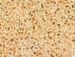 NUDT21 Antibody in Immunohistochemistry (Paraffin) (IHC (P))