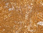 NUDT21 Antibody in Immunohistochemistry (Paraffin) (IHC (P))