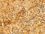 NUDT21 Antibody in Immunohistochemistry (Paraffin) (IHC (P))