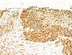 NUDT21 Antibody in Immunohistochemistry (Paraffin) (IHC (P))