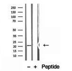 NUDT21 Antibody in Western Blot (WB)