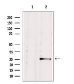 NUDT21 Antibody in Western Blot (WB)