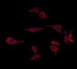 RPGRIP1L Antibody in Immunocytochemistry (ICC/IF)