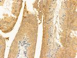 RPGRIP1L Antibody in Immunohistochemistry (Paraffin) (IHC (P))