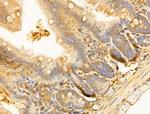 RPGRIP1L Antibody in Immunohistochemistry (Paraffin) (IHC (P))