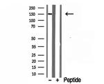 RPGRIP1L Antibody in Western Blot (WB)