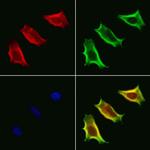 VPS33B Antibody in Immunocytochemistry (ICC/IF)