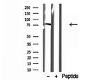 VPS33B Antibody in Western Blot (WB)