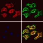 ZCCHC11 Antibody in Immunocytochemistry (ICC/IF)