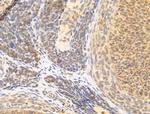 ZCCHC11 Antibody in Immunohistochemistry (Paraffin) (IHC (P))