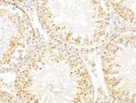 ZCCHC11 Antibody in Immunohistochemistry (Paraffin) (IHC (P))