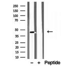 ACADS Antibody in Western Blot (WB)