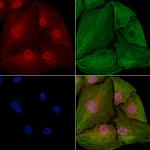 Annexin VII Antibody in Immunocytochemistry (ICC/IF)