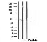 Annexin VII Antibody in Western Blot (WB)