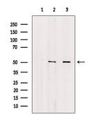 Annexin VII Antibody in Western Blot (WB)