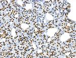 CKAP4 Antibody in Immunohistochemistry (Paraffin) (IHC (P))