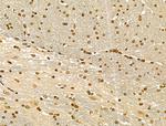 CKAP4 Antibody in Immunohistochemistry (Paraffin) (IHC (P))