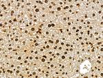 CKAP4 Antibody in Immunohistochemistry (Paraffin) (IHC (P))