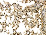 CKAP4 Antibody in Immunohistochemistry (Paraffin) (IHC (P))