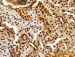 CKAP4 Antibody in Immunohistochemistry (Paraffin) (IHC (P))