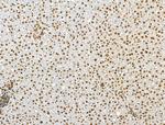 CKAP4 Antibody in Immunohistochemistry (Paraffin) (IHC (P))