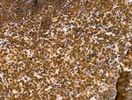 CKAP4 Antibody in Immunohistochemistry (Paraffin) (IHC (P))