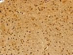 CKAP4 Antibody in Immunohistochemistry (Paraffin) (IHC (P))