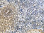 CKAP4 Antibody in Immunohistochemistry (Paraffin) (IHC (P))