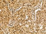 CKAP4 Antibody in Immunohistochemistry (Paraffin) (IHC (P))