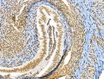 CKAP4 Antibody in Immunohistochemistry (Paraffin) (IHC (P))