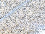 CKAP4 Antibody in Immunohistochemistry (Paraffin) (IHC (P))