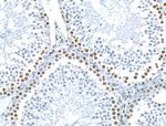 CKAP4 Antibody in Immunohistochemistry (Paraffin) (IHC (P))