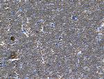 CKAP4 Antibody in Immunohistochemistry (Paraffin) (IHC (P))