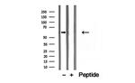 CKAP4 Antibody in Western Blot (WB)