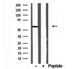 CYP26B1 Antibody in Western Blot (WB)