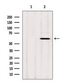 CYP26B1 Antibody in Western Blot (WB)