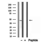 HLA-F Antibody in Western Blot (WB)